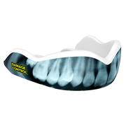 Damage Control High Impact MouthGuard - X-ray 2.0