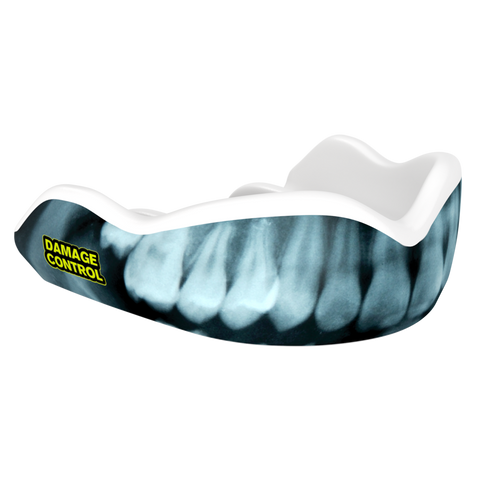 Damage Control High Impact MouthGuard - X-ray 2.0